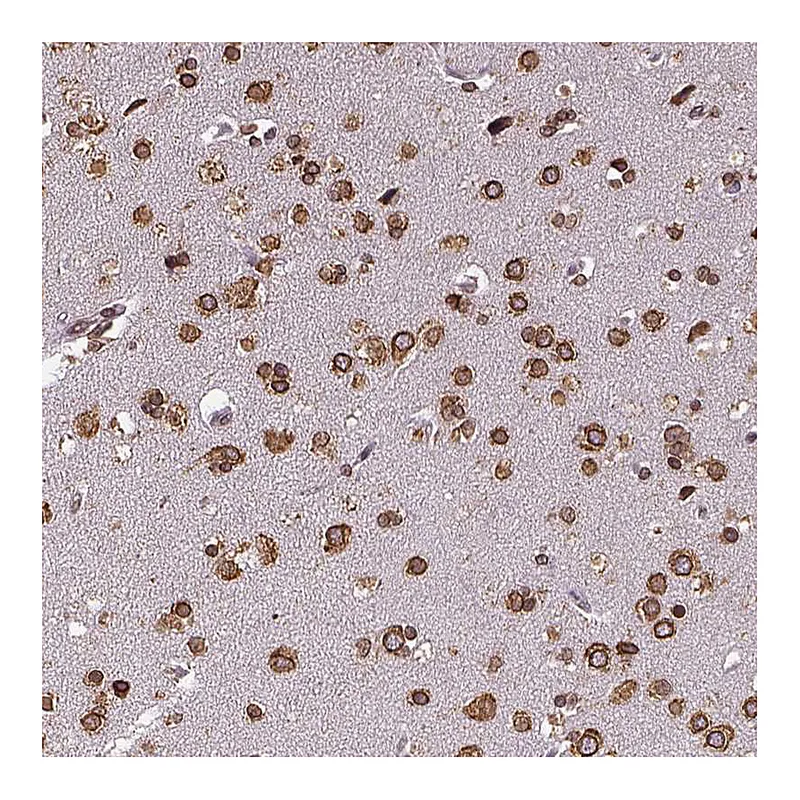 Atlas Antibodies Anti-MTDH Antibody