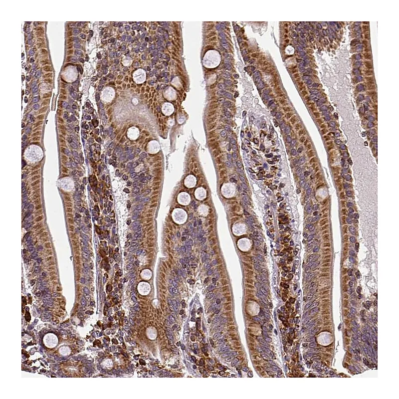 Atlas Antibodies Anti-MTDH Antibody