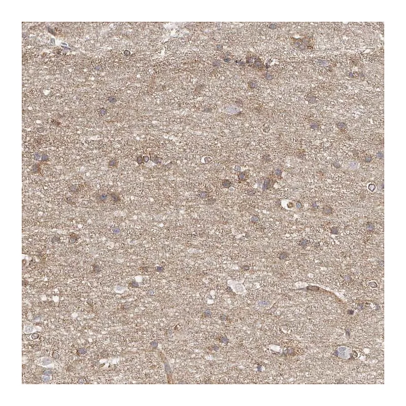Atlas Antibodies Anti-MTERF4 Antibody
