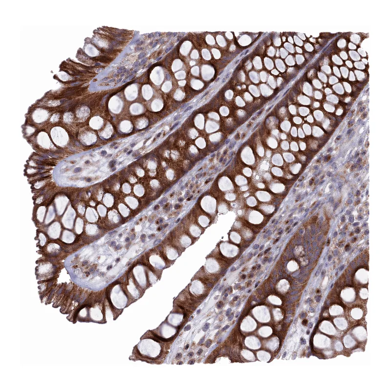 Atlas Antibodies Anti-MTFMT Antibody