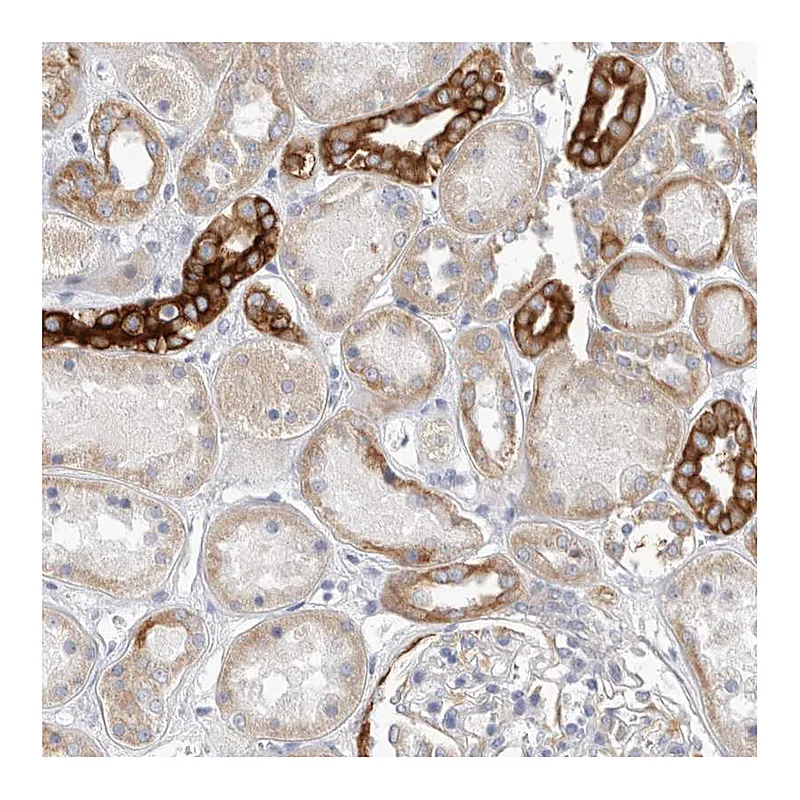 Atlas Antibodies Anti-MTFR1L Antibody