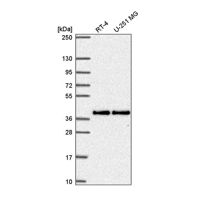 Atlas Antibodies Anti-MTFR1 Antibody