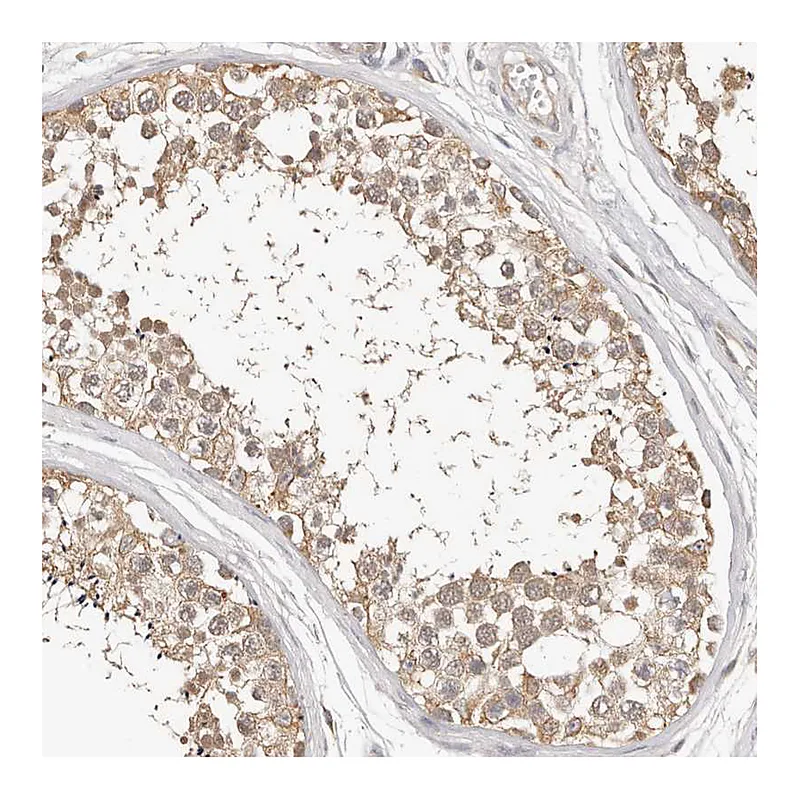Atlas Antibodies Anti-MTFR2 Antibody