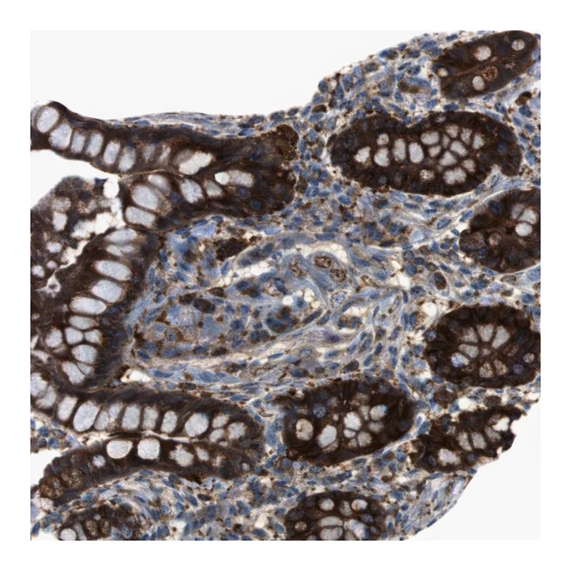 Atlas Antibodies Anti-MTHFD1 Antibody