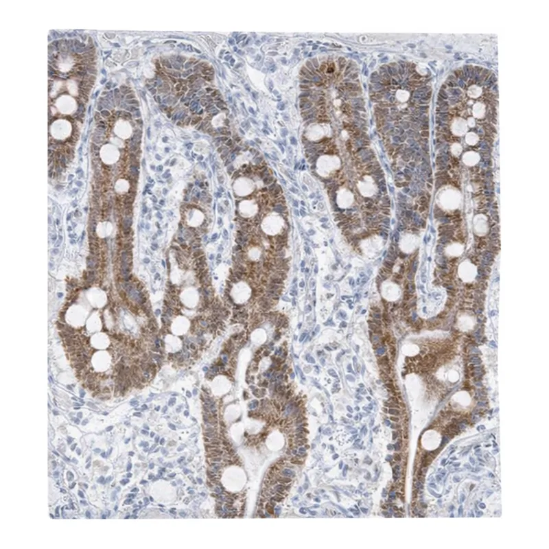 Atlas Antibodies Anti-MTG1 Antibody
