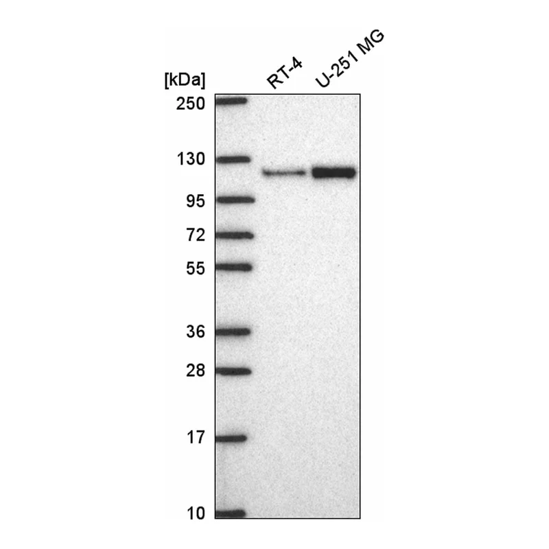 Atlas Antibodies Anti-MTHFD1L Antibody