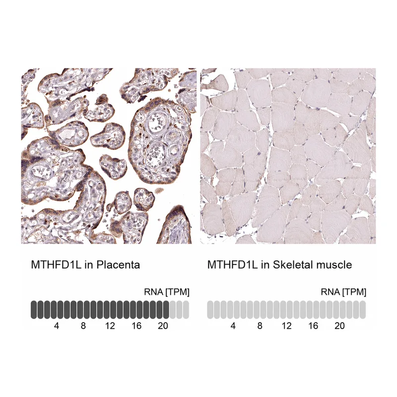 Atlas Antibodies Anti-MTHFD1L Antibody
