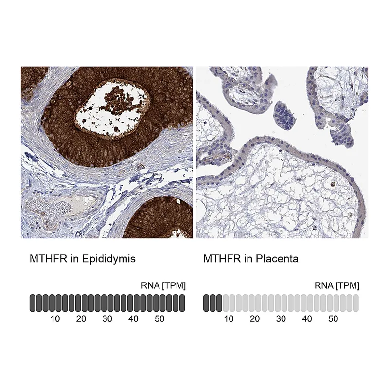 Atlas Antibodies Anti-MTHFR Antibody