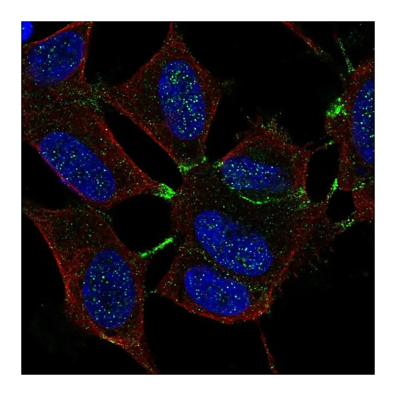 Atlas Antibodies Anti-MTHFR Antibody