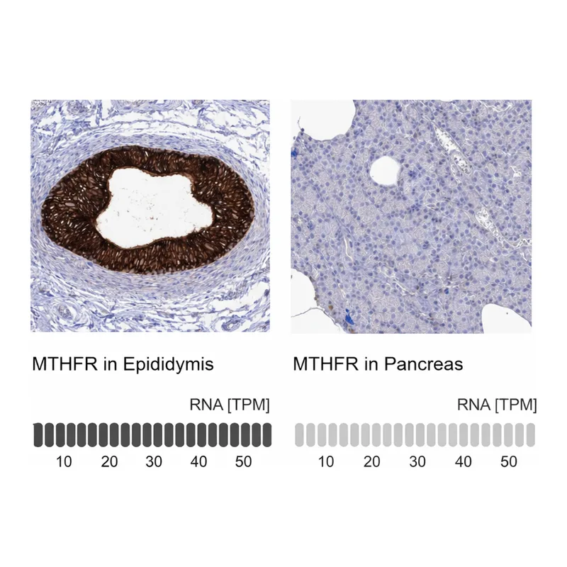 Atlas Antibodies Anti-MTHFR Antibody