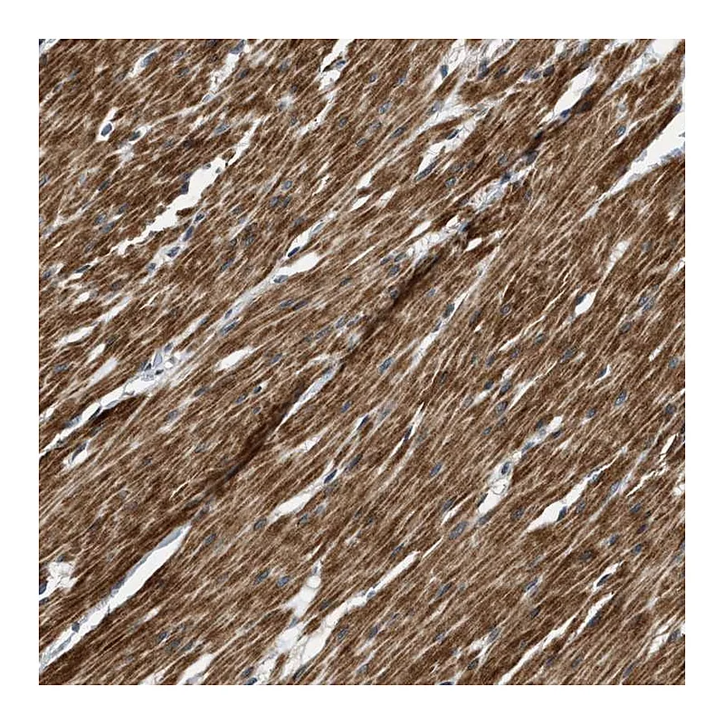 Atlas Antibodies Anti-MTMR1 Antibody