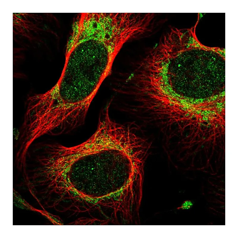 Atlas Antibodies Anti-MTIF2 Antibody