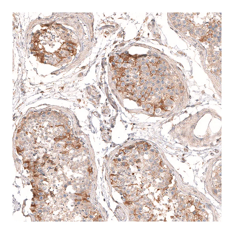 Atlas Antibodies Anti-MTM1 Antibody