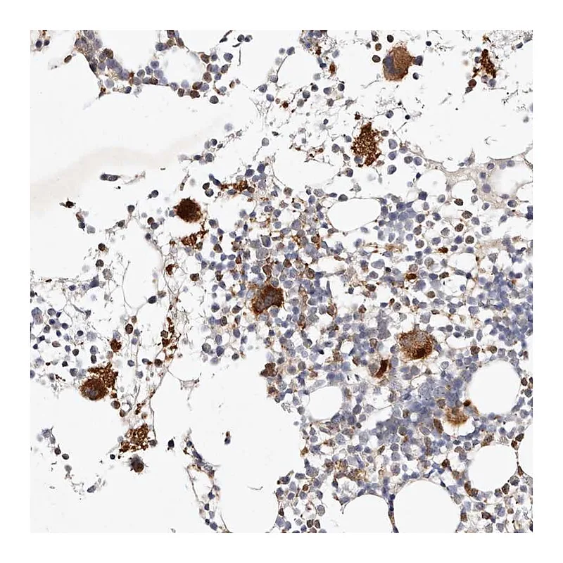 Atlas Antibodies Anti-MTMR11 Antibody