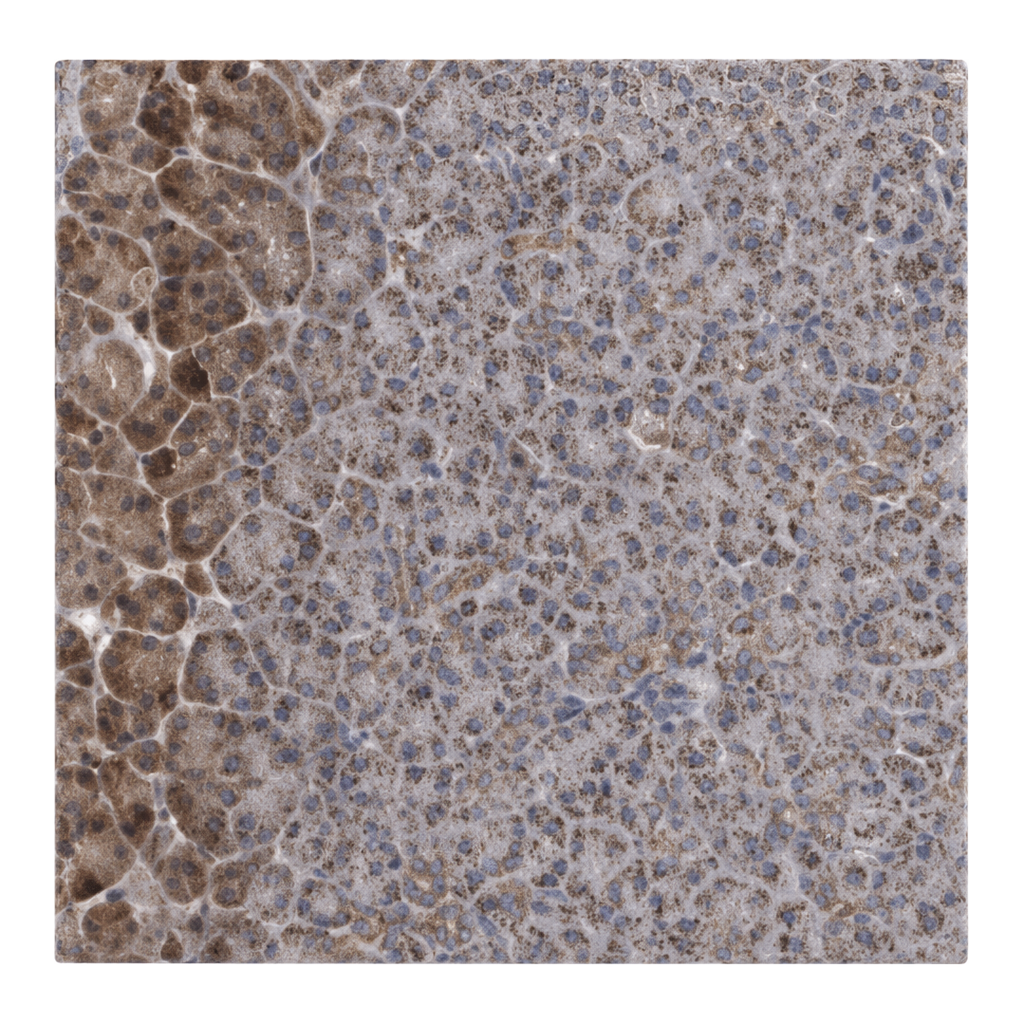 Atlas Antibodies Anti-MTMR12 Antibody