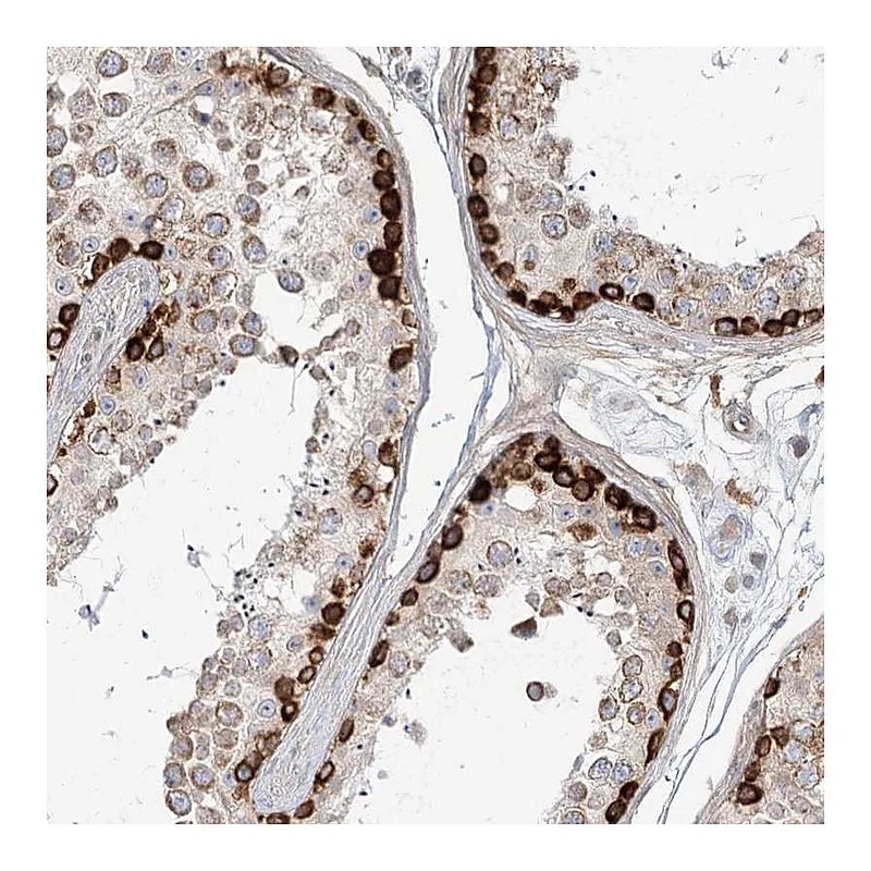 Atlas Antibodies Anti-MTMR3 Antibody