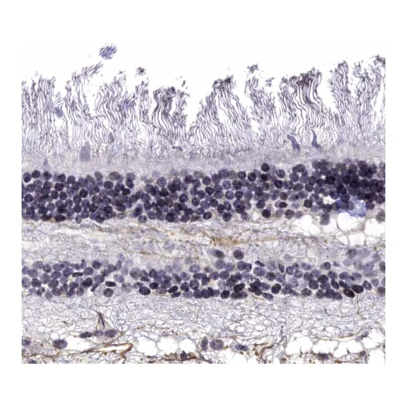 Atlas Antibodies Anti-MTNR1B Antibody