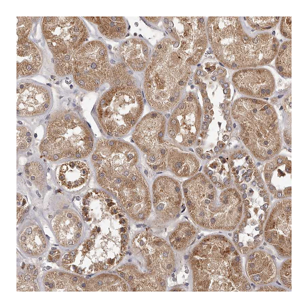 Atlas Antibodies Anti-MTO1 Antibody