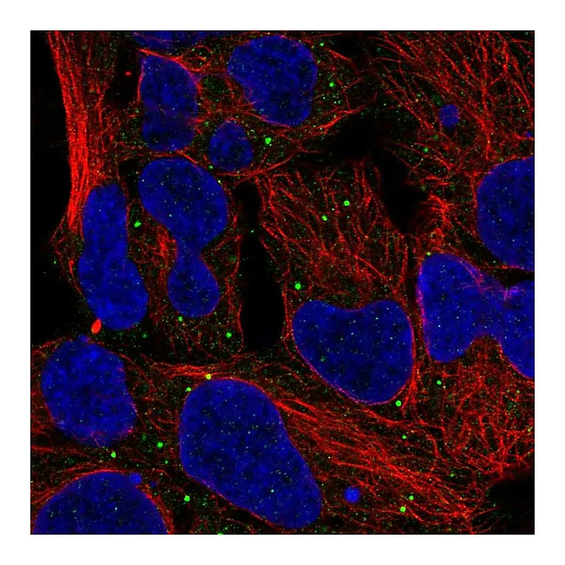 Atlas Antibodies Anti-MTOR Antibody