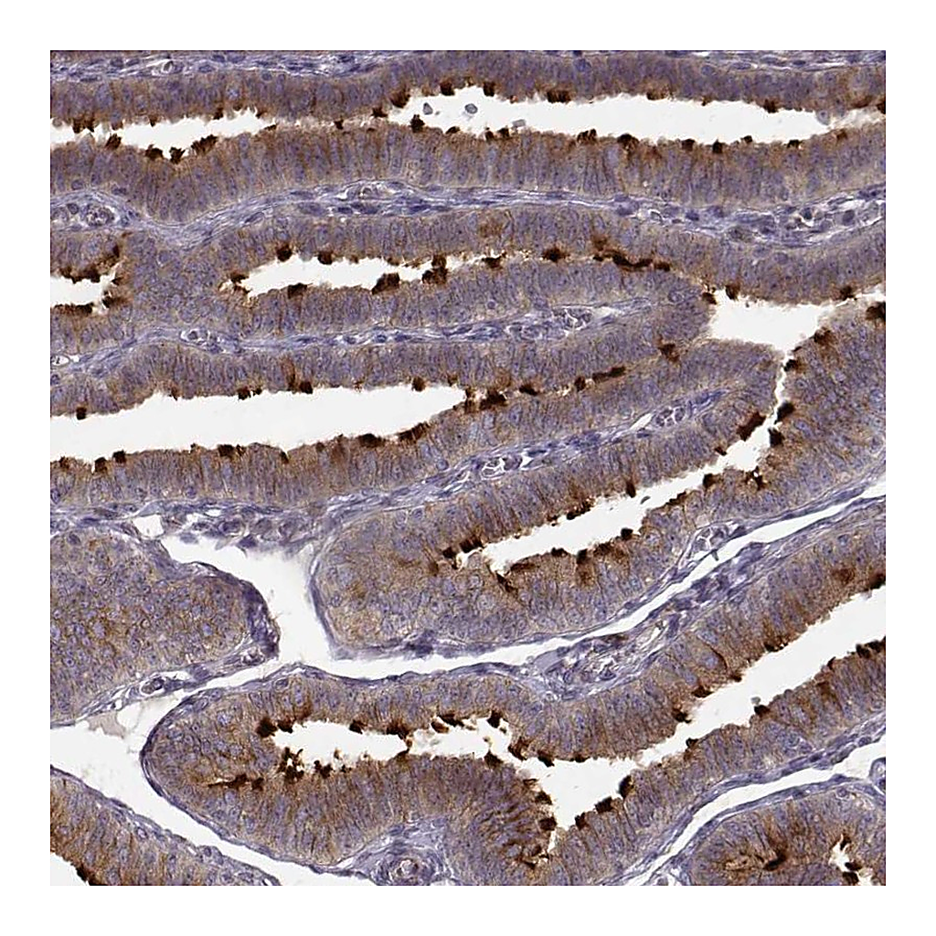 Atlas Antibodies Anti-MTR Antibody