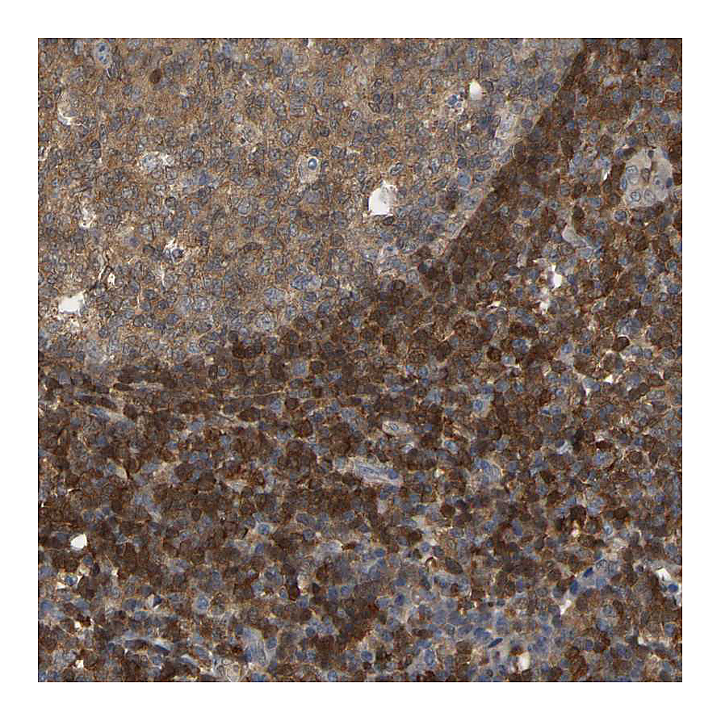 Atlas Antibodies Anti-MTPN Antibody