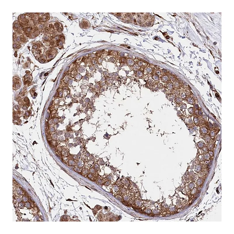 Atlas Antibodies Anti-MTPAP Antibody