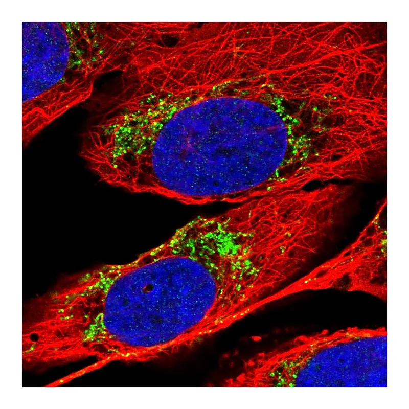 Atlas Antibodies Anti-MTPAP Antibody