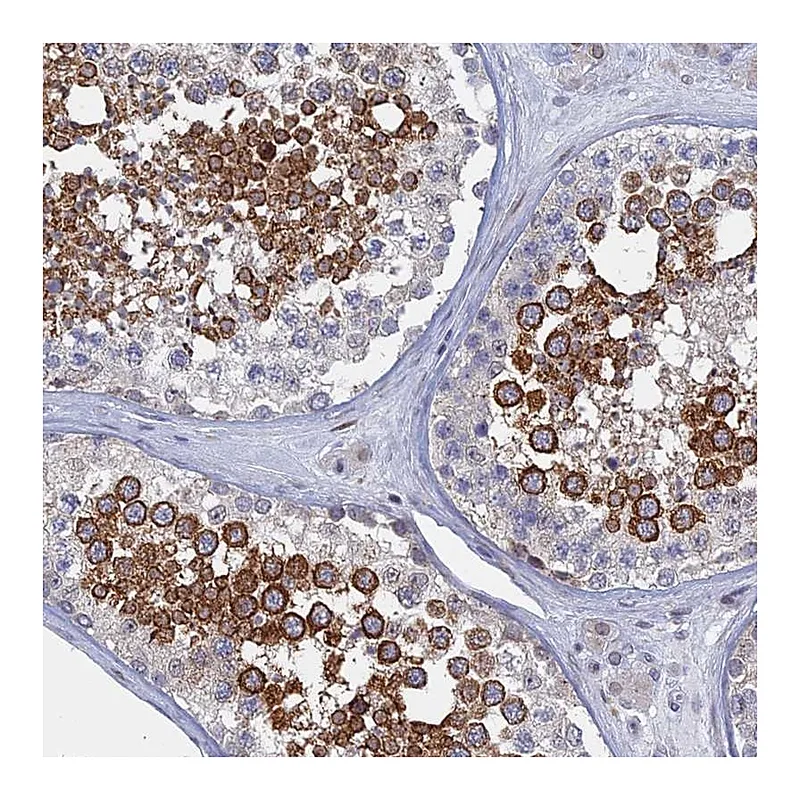 Atlas Antibodies Anti-MTRF1 Antibody