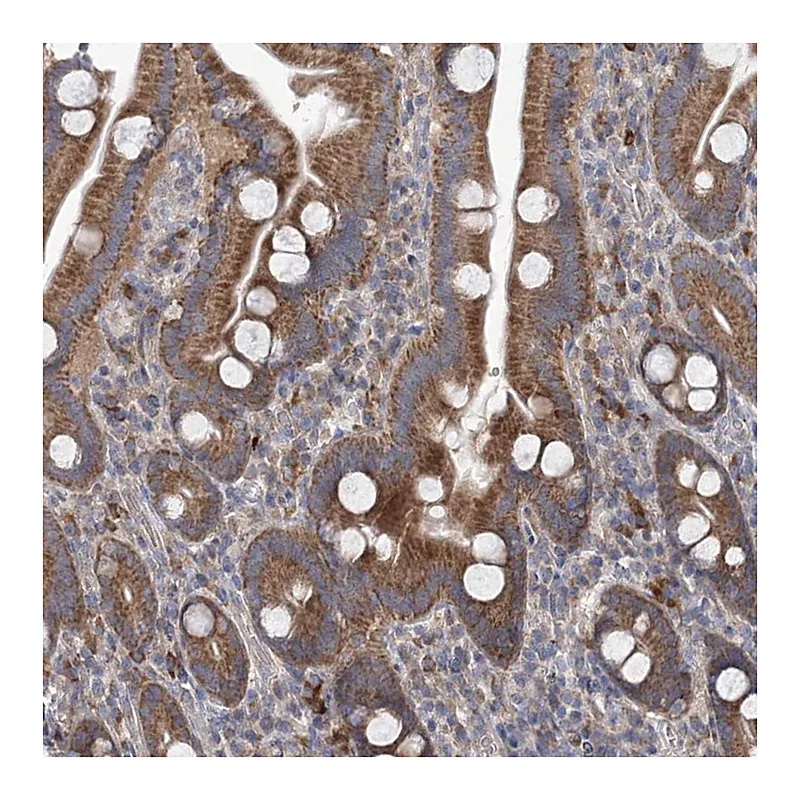 Atlas Antibodies Anti-MTRF1L Antibody