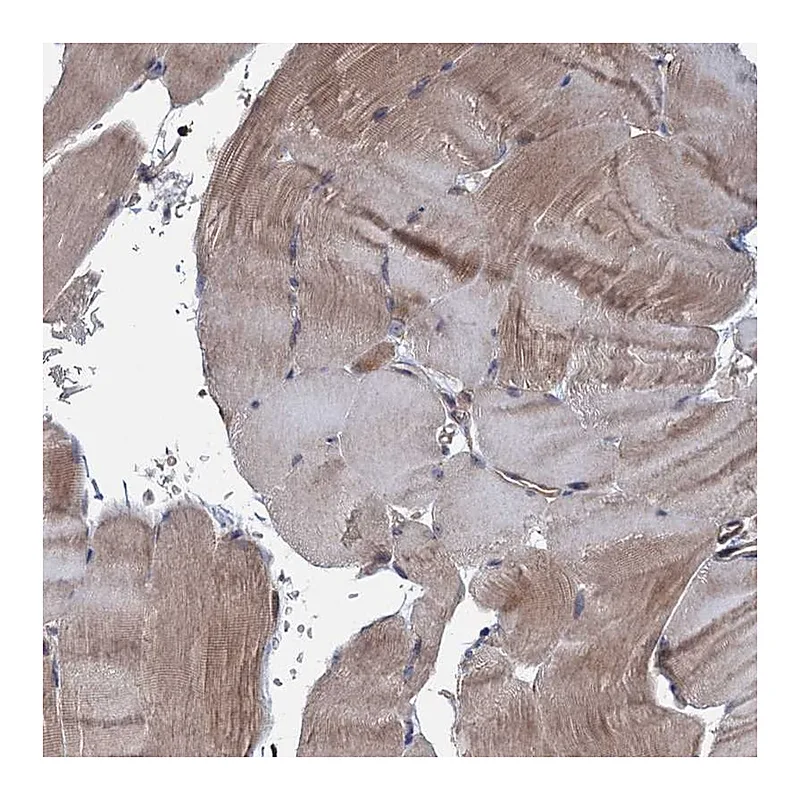 Atlas Antibodies Anti-MTRR Antibody