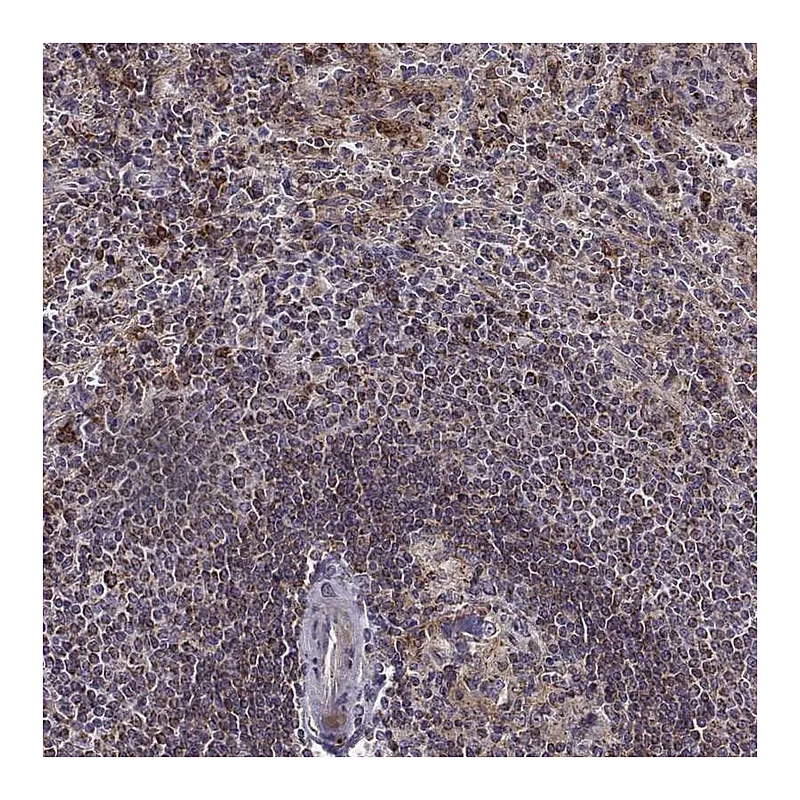 Atlas Antibodies Anti-MTSS1 Antibody