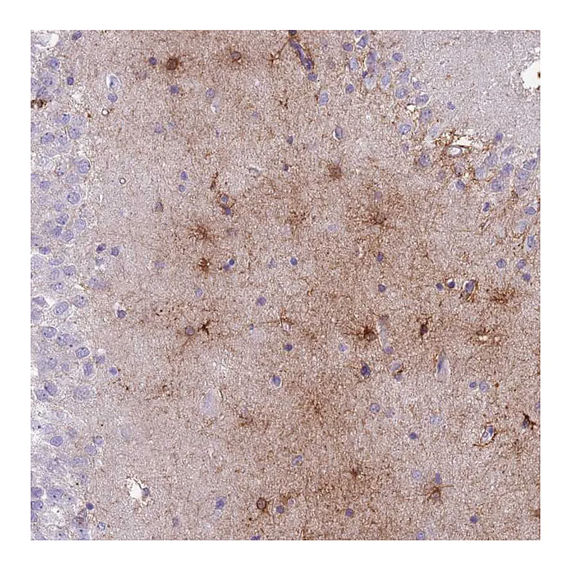 Atlas Antibodies Anti-MTSS1L Antibody