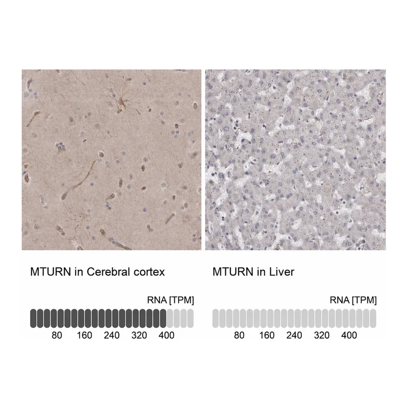 Atlas Antibodies Anti-MTURN Antibody