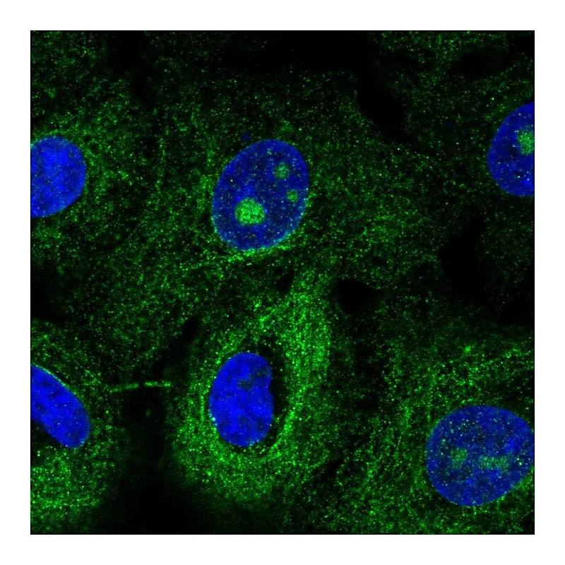 Atlas Antibodies Anti-MTUS1 Antibody