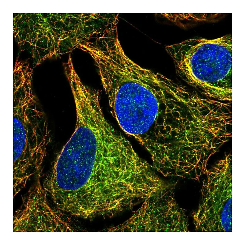 Atlas Antibodies Anti-MTUS1 Antibody