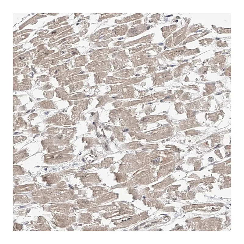 Atlas Antibodies Anti-MTUS2 Antibody