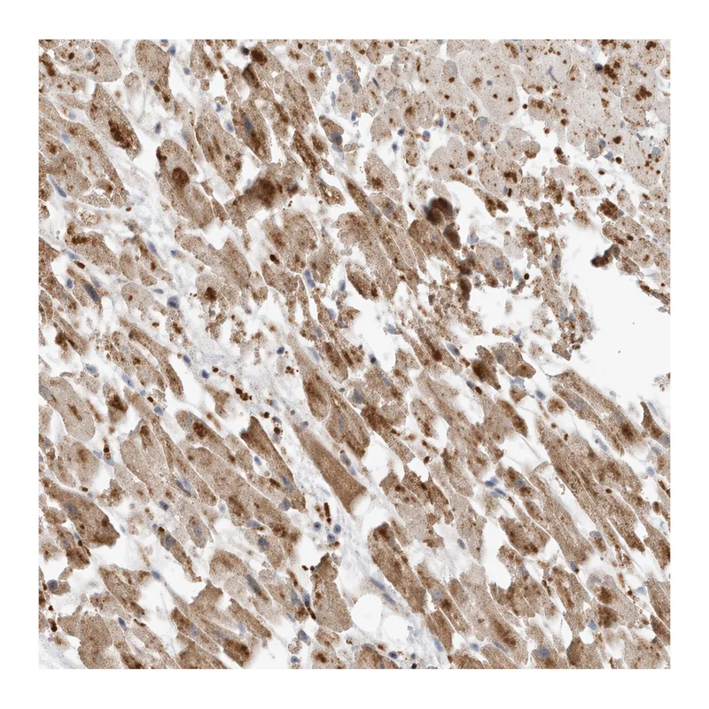 Atlas Antibodies Anti-MTUS2 Antibody