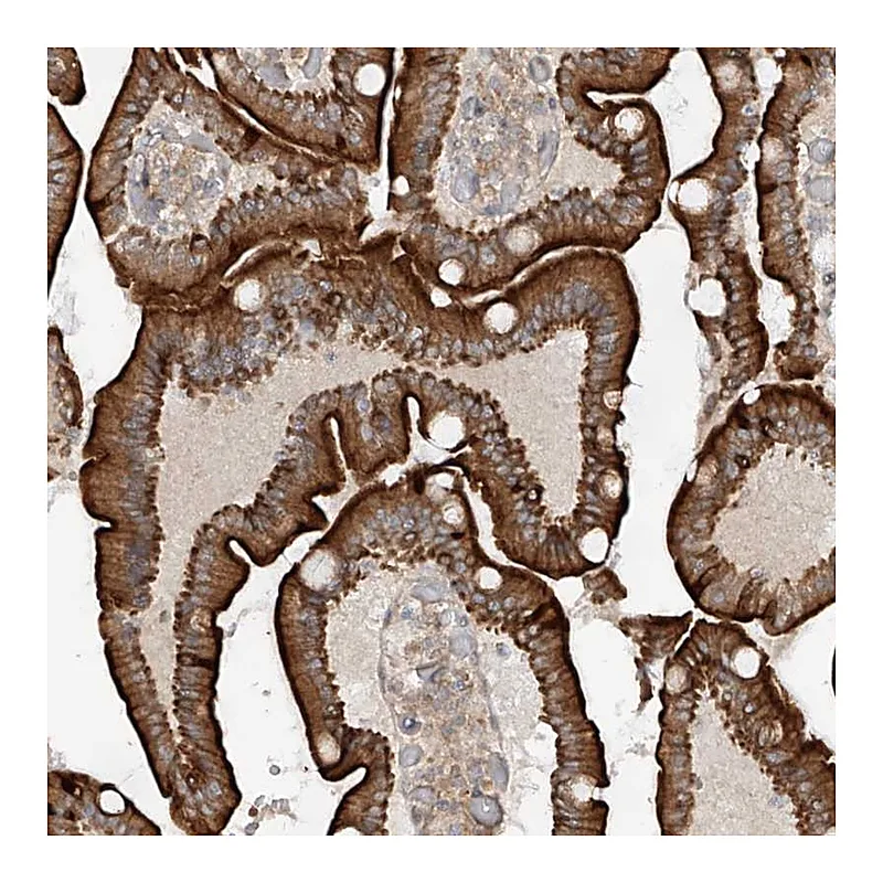 Atlas Antibodies Anti-MTUS2 Antibody