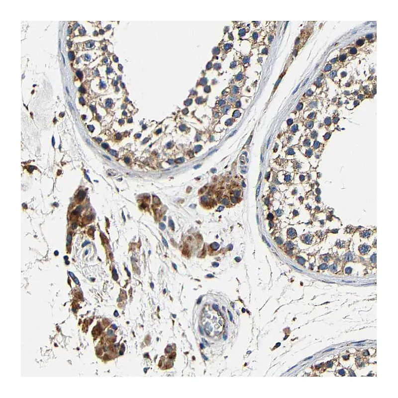 Atlas Antibodies Anti-MTX1 Antibody