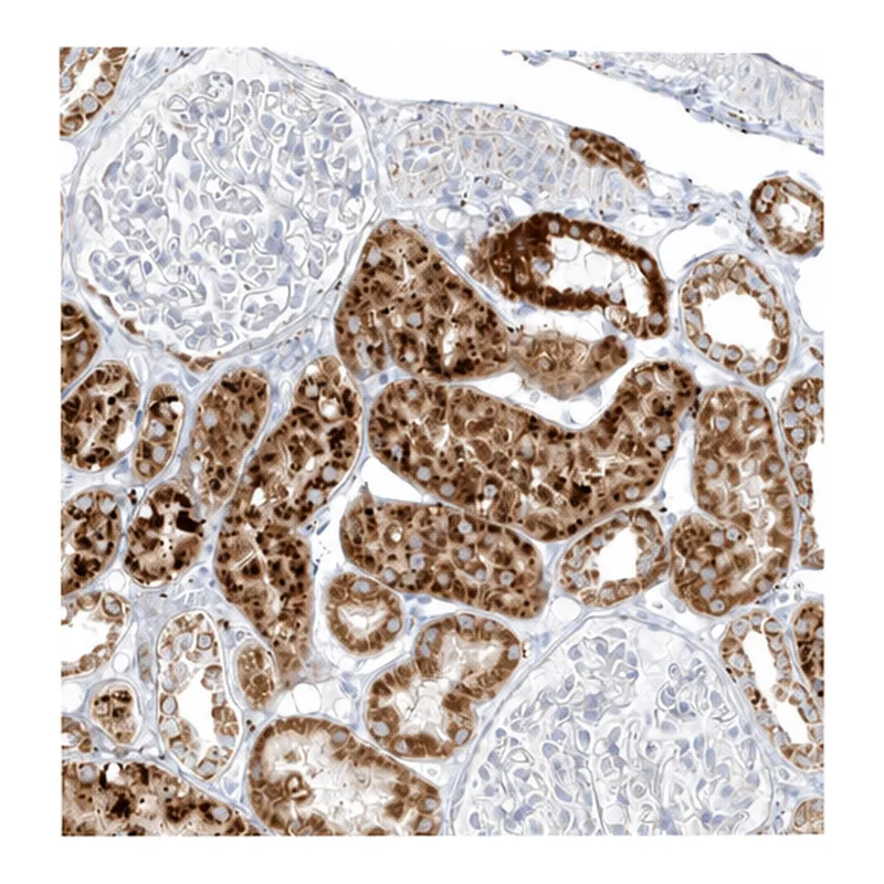 Atlas Antibodies Anti-MTX2 Antibody