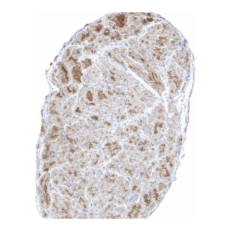 Atlas Antibodies Anti-MTX2 Antibody