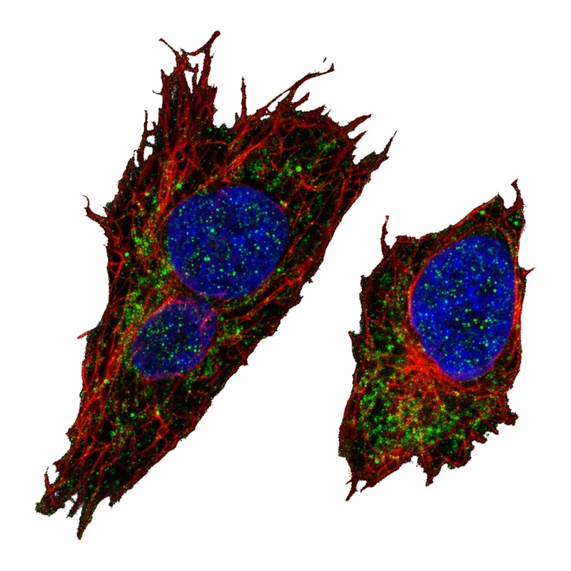 Atlas Antibodies Anti-MTX3 Antibody