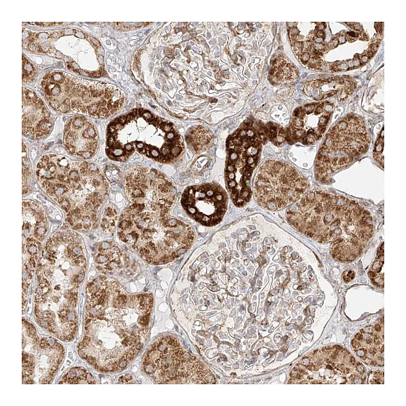 Atlas Antibodies Anti-MTX2 Antibody