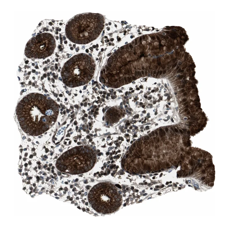 Atlas Antibodies Anti-MUC1 Antibody
