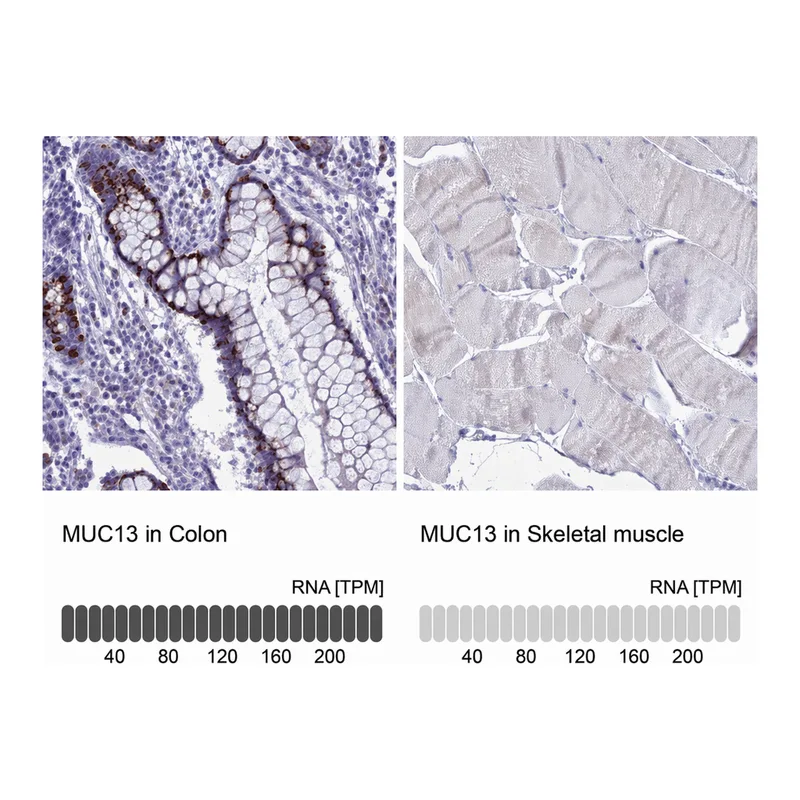 Atlas Antibodies Anti-MUC13 Antibody