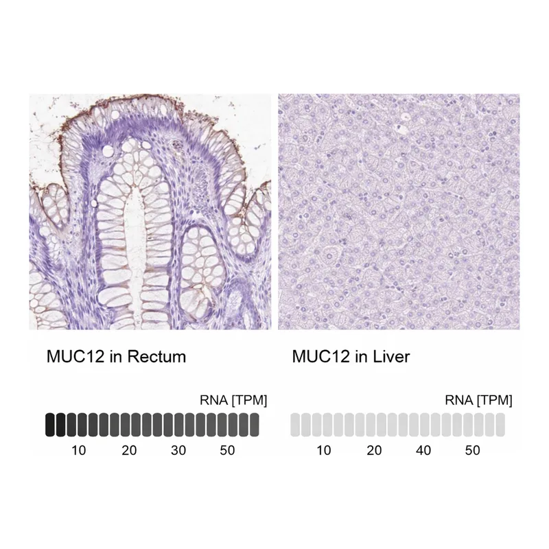 Atlas Antibodies Anti-MUC12 Antibody