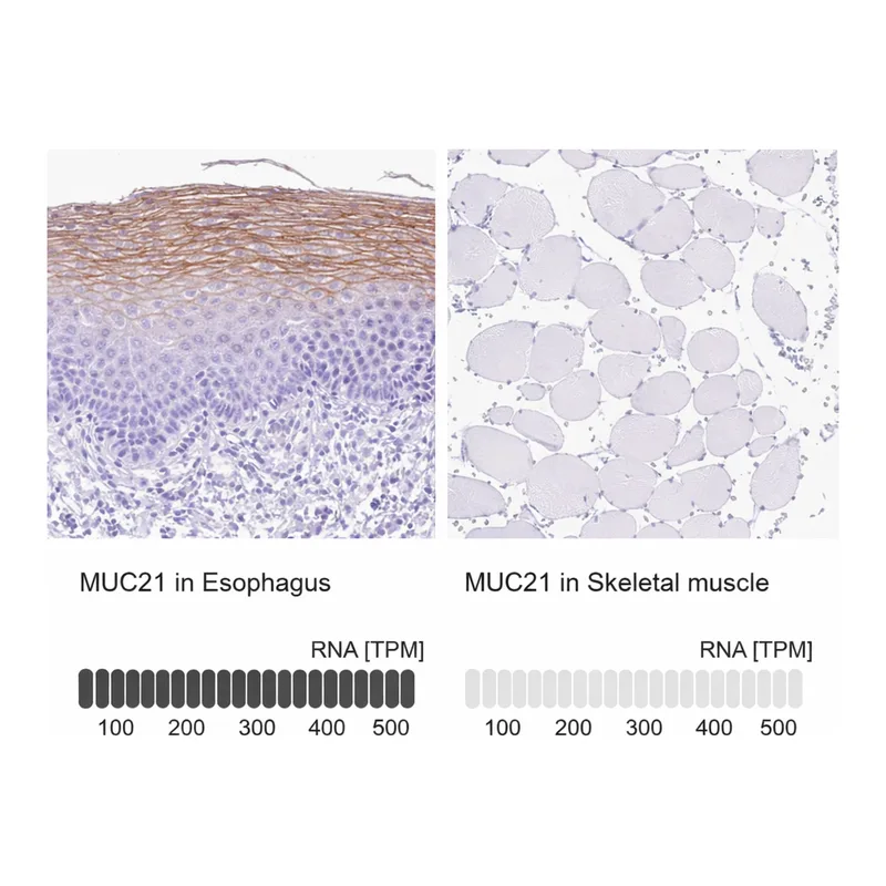 Atlas Antibodies Anti-MUC21 Antibody