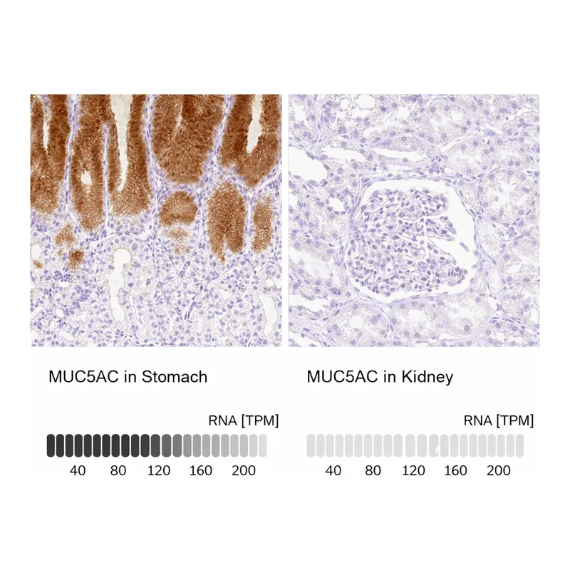 Atlas Antibodies Anti-MUC5AC Antibody