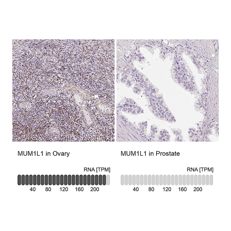 Atlas Antibodies Anti-MUM1L1 Antibody