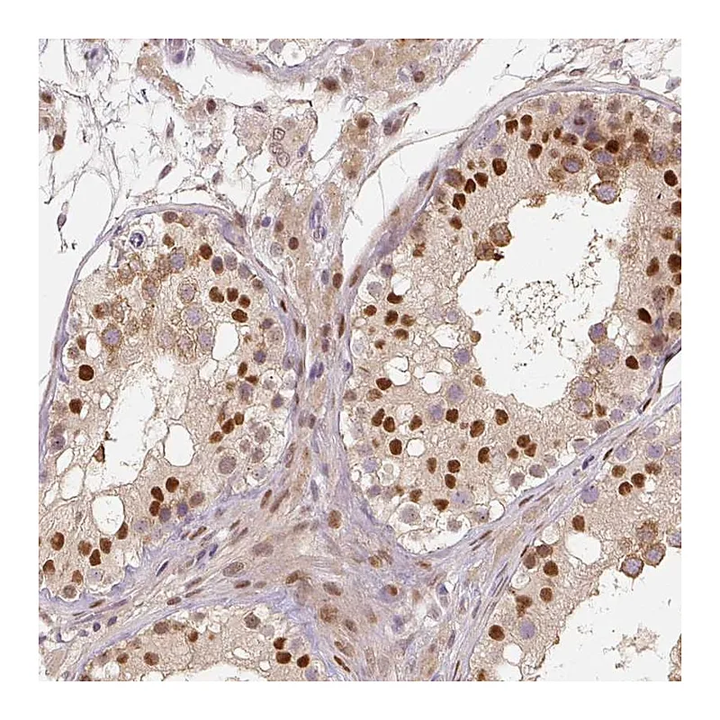 Atlas Antibodies Anti-MUM1L1 Antibody